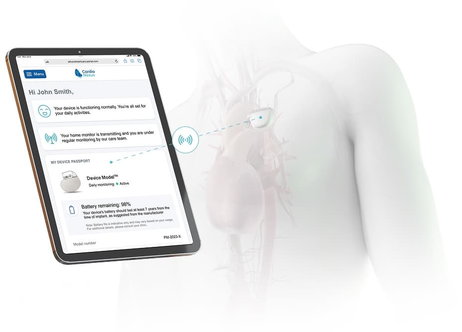 Image of CardioNexus